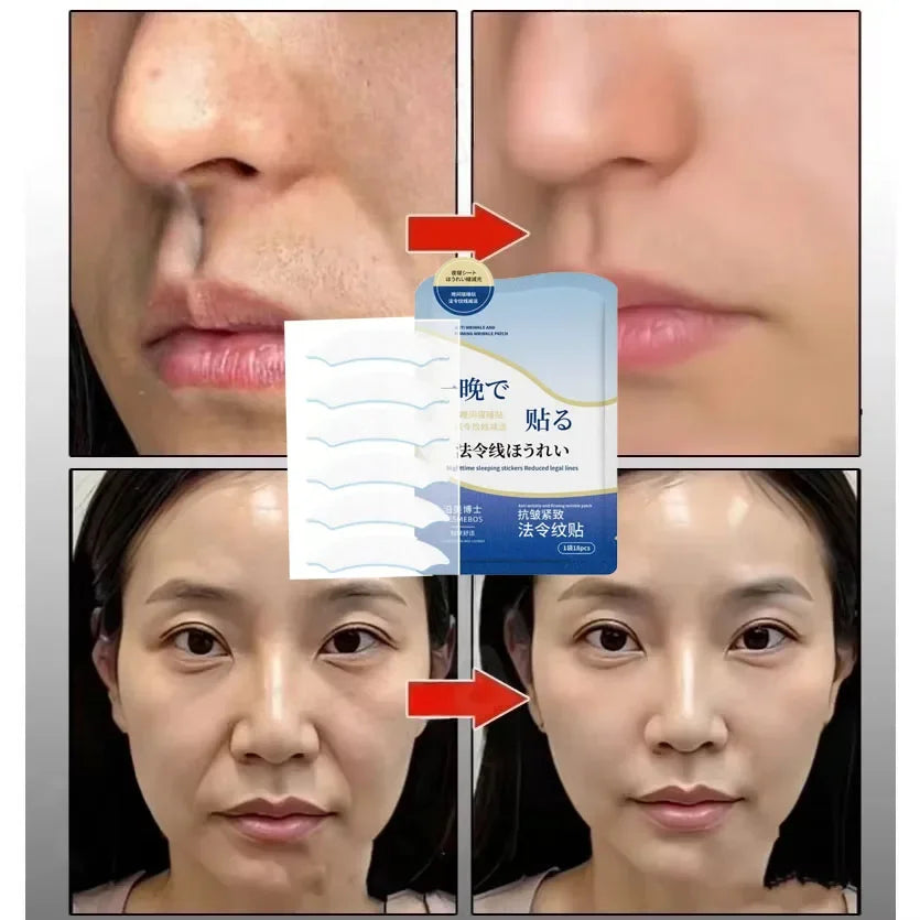 Retinol Collagen Anti-Wrinkle Patch